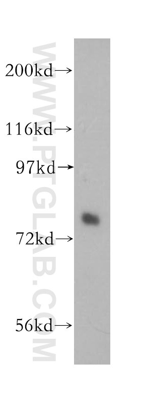 PLXNB2 western blot WB 10602-1-AP PLXNB2 Antibody KIAA0315; MM1; Nbla00445; PLEXB2; dJ402G11.3