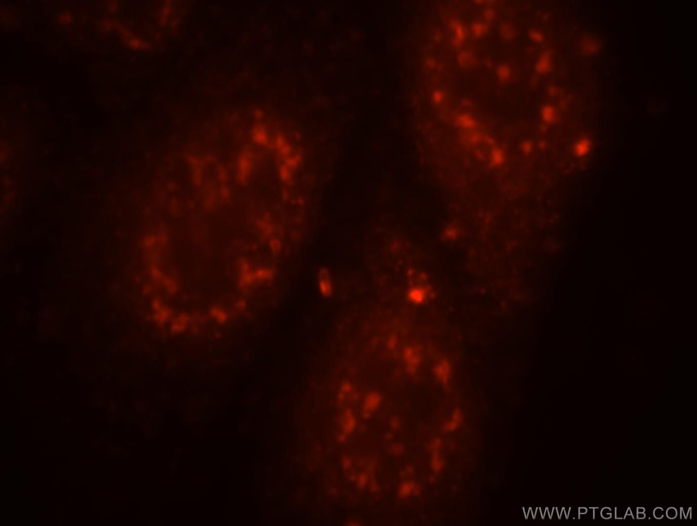 PNN Immunofluorescence IF 18266-1-AP PNN Antibody DRS; SDK3; memA; pinin