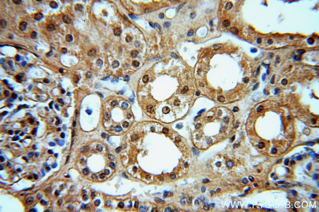 PNN IHC Immunohistochemical 18266-1-AP PNN Antibody DRS; SDK3; memA; pinin