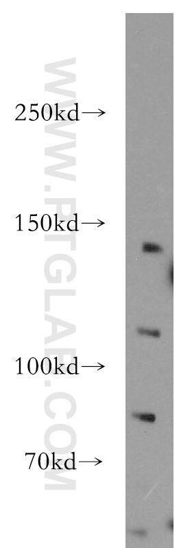 PNN western blot WB 18266-1-AP PNN Antibody DRS; SDK3; memA; pinin