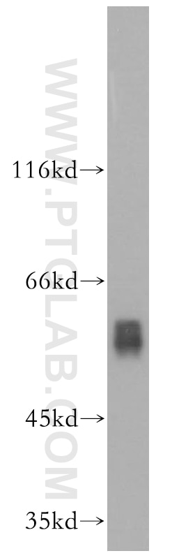 PPARA western blot WB 15540-1-AP PPARA Antibody MGC2237; MGC2452; NR1C1; PPAR; hPPAR
