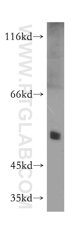 mouse heart tissue were subjected to SDS PAGE followed by western blot with 10156-2-AP(PPARD Antibody) at dilution of 1:500 PPARD western blot WB 10156-2-AP PPARD Antibody FAAR; MGC3931; NR1C2; NUC1; NUCI; NUCII; PPAR-beta; PPARB