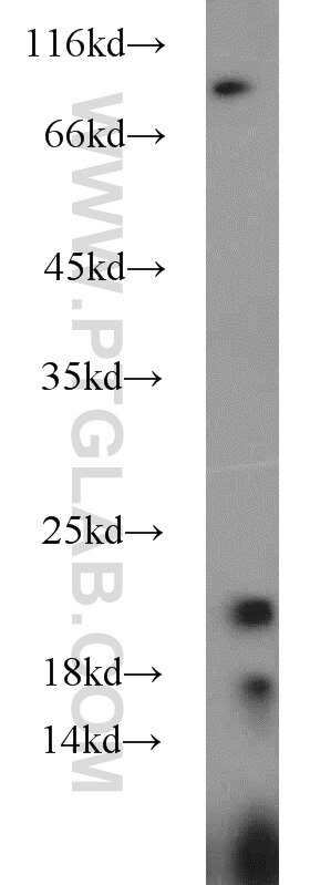 HEK-293 cells were subjected to SDS PAGE followed by western blot with 10287-2-AP(PPIC Antibody) at dilution of 1:1000 PPIC western blot WB 10287-2-AP PPIC Antibody CYPC; MGC3673