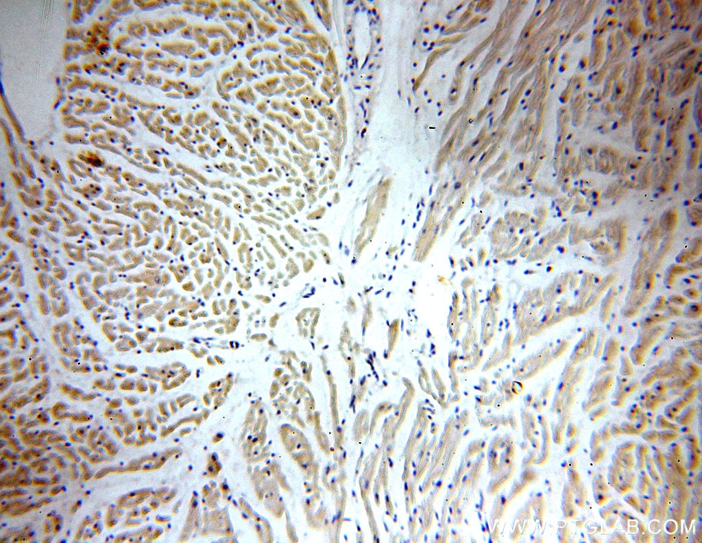 PPIF-Specific IHC Immunohistochemical 18466-1-AP PPIF-Specific Antibody CYP3; Cyp-D; FLJ90798; MGC117207