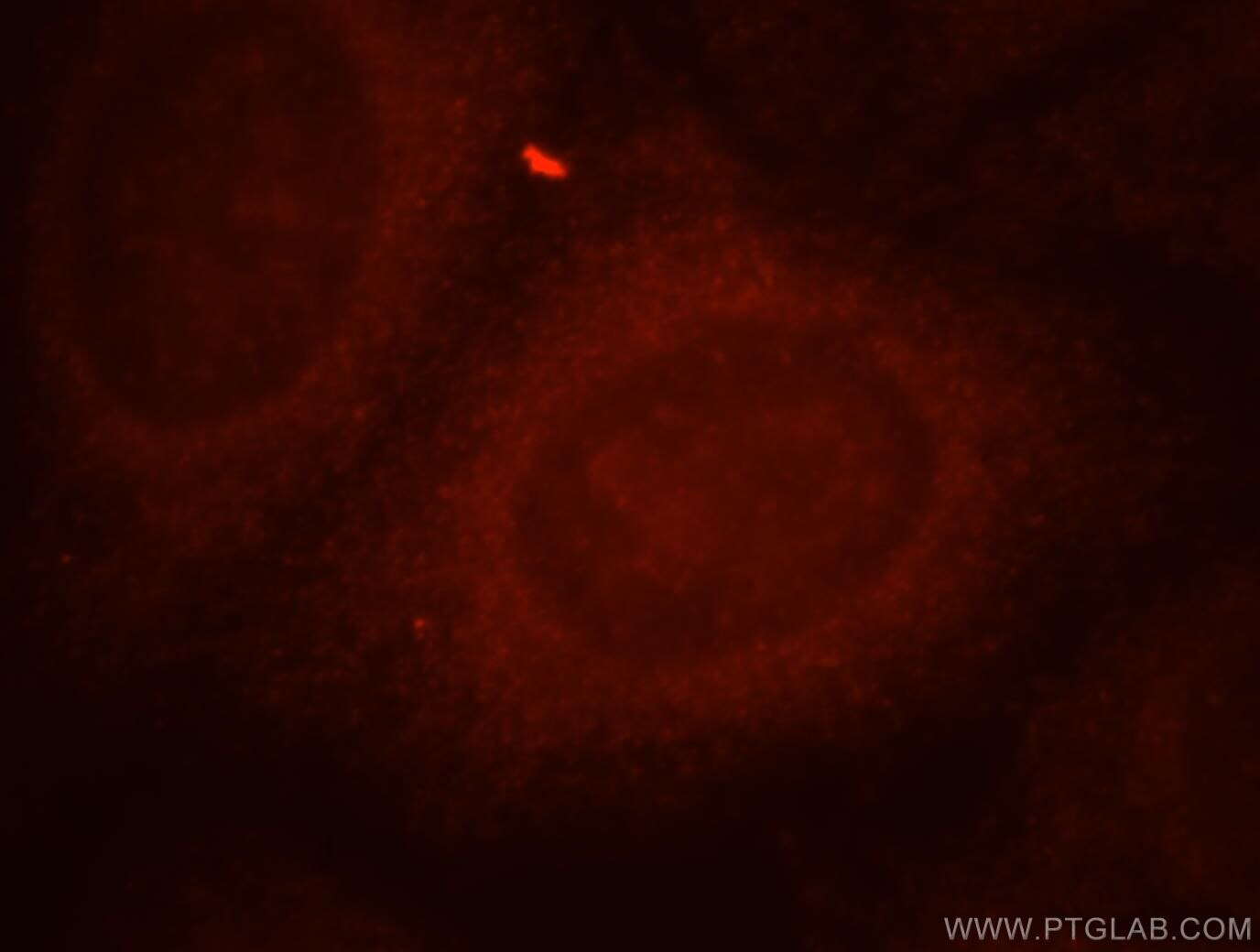 Immunofluorescent analysis of HepG2 cells, using PPM1L antibody 18203-1-AP at 1:25 dilution and Rhodamine-labeled goat anti-rabbit IgG (red). PPM1L Immunofluorescence IF 18203-1-AP PPM1L Antibody MGC132545; MGC132547; PP2C-epsilon; PP2CE; PPM1-LIKE