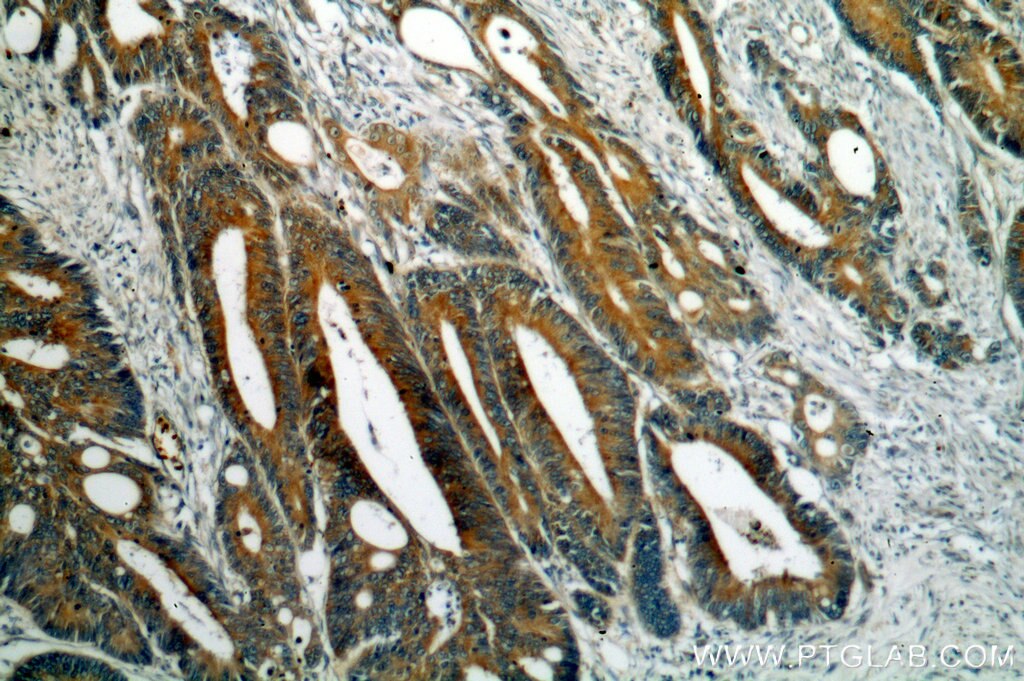 antibodi