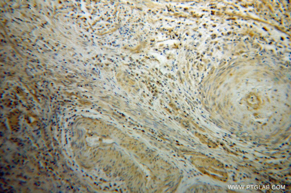PPP3CA IHC Immunohistochemical 13422-1-AP PPP3CA Antibody CALN; CALNA; CALNA1; CCN1; CNA1; PPP2B