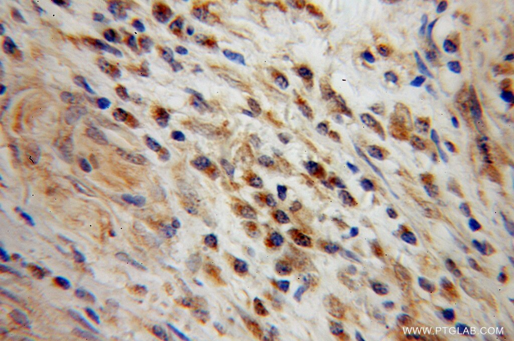 PPP3CA IHC Immunohistochemical 13422-1-AP PPP3CA Antibody CALN; CALNA; CALNA1; CCN1; CNA1; PPP2B