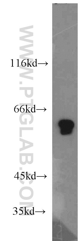 PPP3CA western blot WB 13422-1-AP PPP3CA Antibody CALN; CALNA; CALNA1; CCN1; CNA1; PPP2B