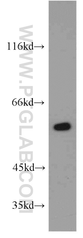 mouse brain tissue were subjected to SDS PAGE followed by western blot with 55148-1-AP(PPP3CB Antibody) at dilution of 1:600 PPP3CB western blot WB 55148-1-AP PPP3CB Antibody CALNA2; CALNB