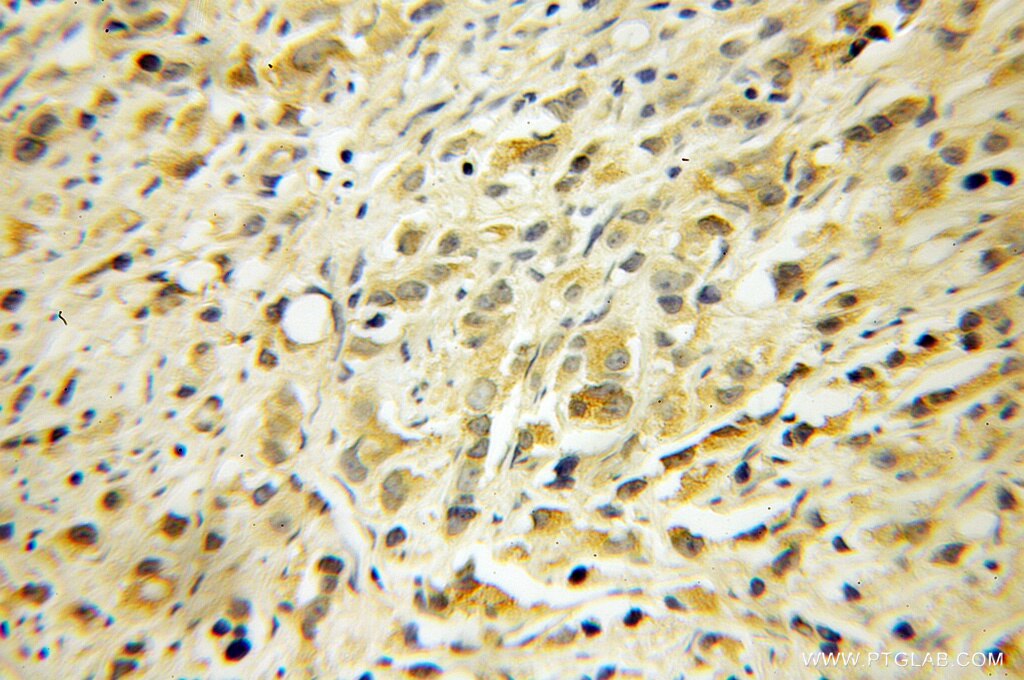 PPP3R1 IHC Immunohistochemical 13210-1-AP PPP3R1 Antibody PPP3R1;CALNB1;CNB;CNB1 ;