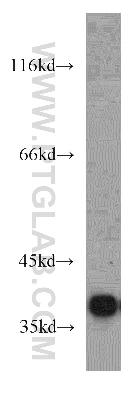 HeLa cells were subjected to SDS PAGE followed by western blot with 16264-1-AP(PQBP1 Antibody) at dilution of 1:1000 PQBP1 western blot WB 16264-1-AP PQBP1 Antibody MRX55; MRXS3; MRXS8; NPW38; RENS1; SHS