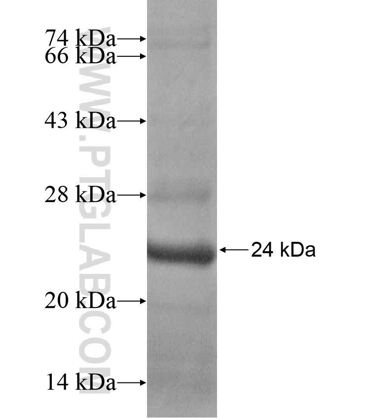 PRDM7 fusion protein ag17226 SDS-PAGE