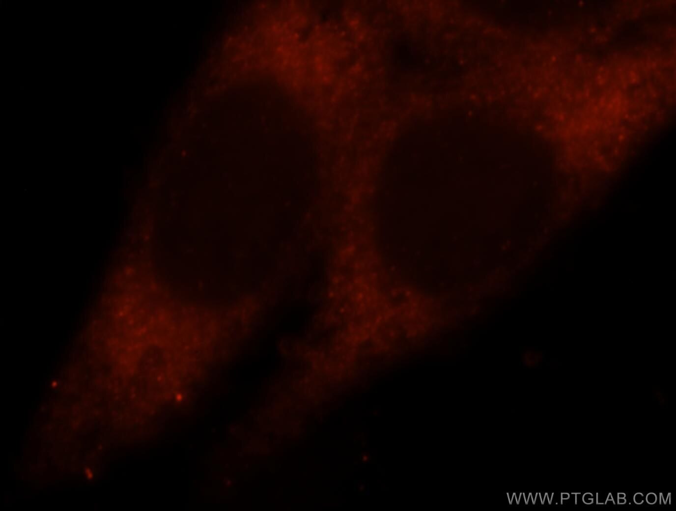 PRDX1 Immunofluorescence IF 15816-1-AP PRDX1 Antibody MSP23; NKEFA; PAG; PAGA; PAGB; PRX1; PRXI; TDPX2