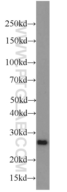 PRDX1 western blot WB 15816-1-AP PRDX1 Antibody MSP23; NKEFA; PAG; PAGA; PAGB; PRX1; PRXI; TDPX2