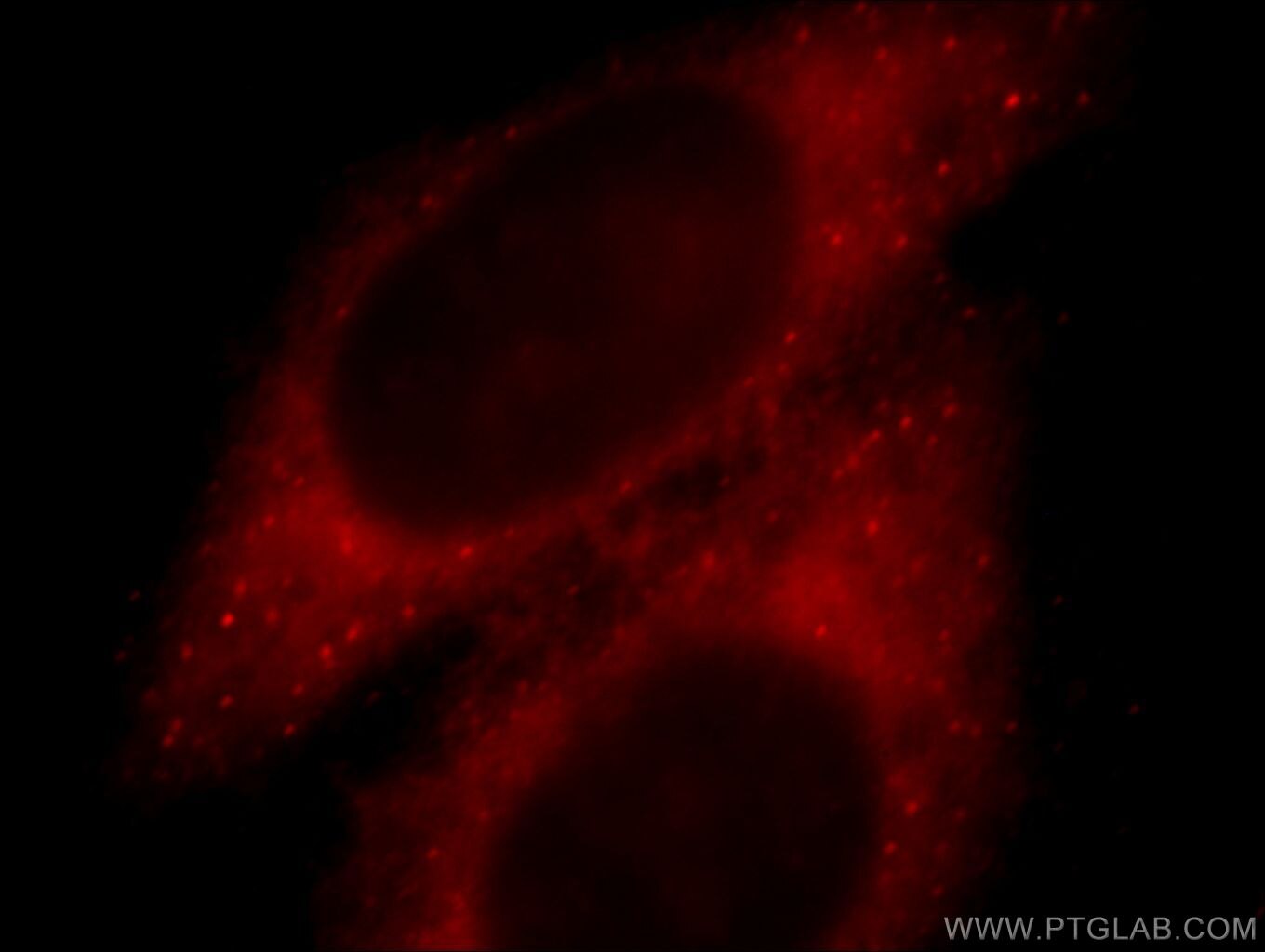 Immunofluorescent analysis of HepG2 cells, using PRDX1 antibody 20568-1-AP at 1:25 dilution and Rhodamine-labeled goat anti-rabbit IgG (red). PRDX1 Immunofluorescence IF 20568-1-AP PRDX1 Antibody MSP23; NKEFA; PAG; PAGA; PAGB; PRX1; PRXI; TDPX2