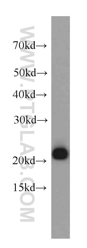 HeLa cells were subjected to SDS PAGE followed by western blot with 20568-1-AP(PRDX1 Antibody) at dilution of 1:2000 PRDX1 western blot WB 20568-1-AP PRDX1 Antibody MSP23; NKEFA; PAG; PAGA; PAGB; PRX1; PRXI; TDPX2