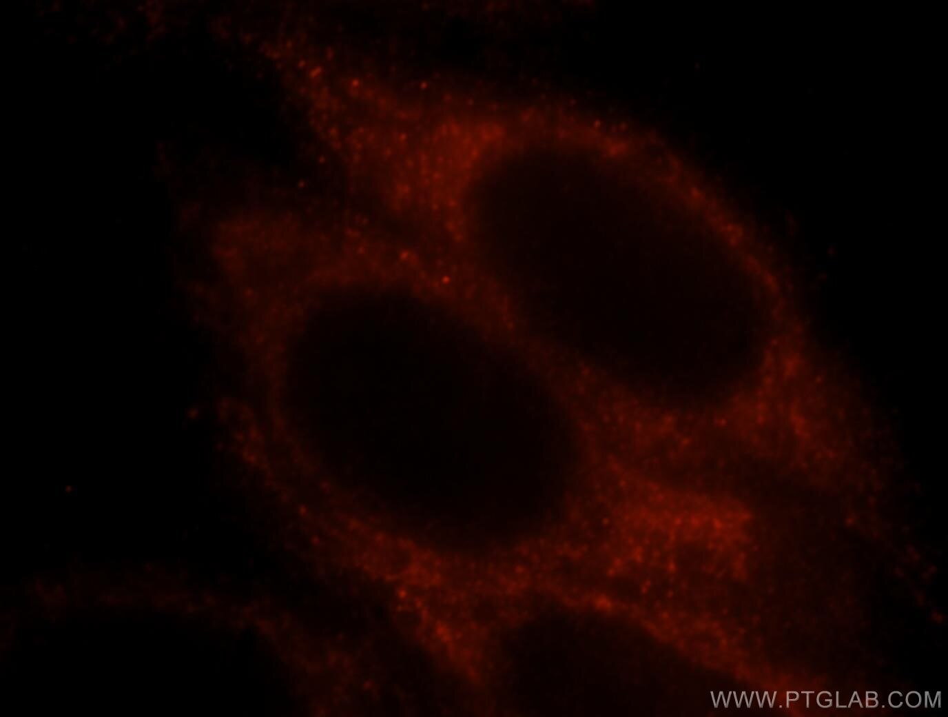 Prx5 Immunofluorescence IF 17724-1-AP Prx5 Antibody ACR1; AOEB166; B166; MGC117264; MGC142283; MGC142285; PLP; PMP20; PRDX6; PRXV; SBBI10