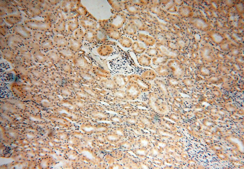 Prx5 IHC Immunohistochemical 17724-1-AP Prx5 Antibody ACR1; AOEB166; B166; MGC117264; MGC142283; MGC142285; PLP; PMP20; PRDX6; PRXV; SBBI10