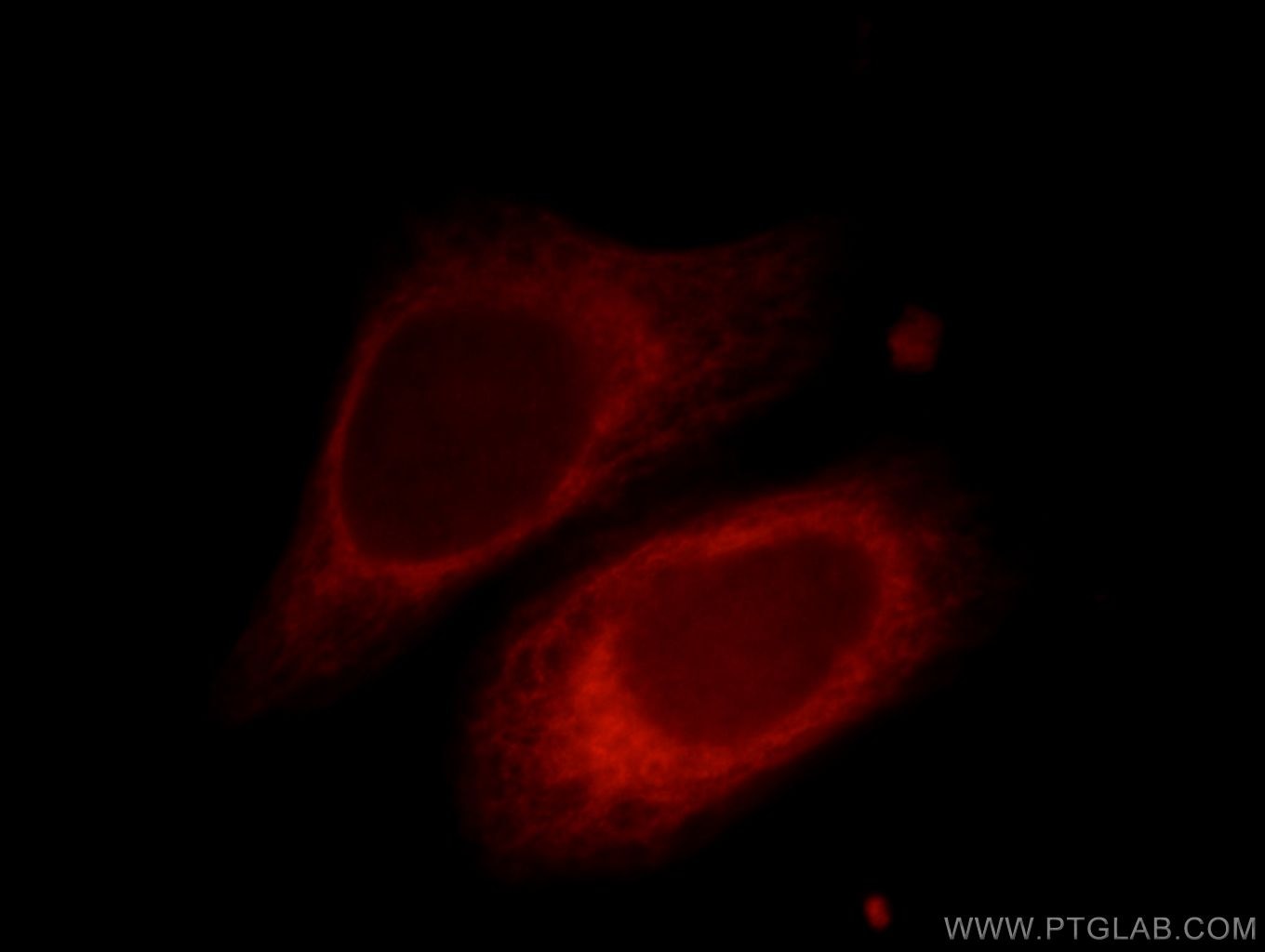 PRKACB Immunofluorescence IF 12232-1-AP PRKACB Antibody DKFZp781I2452; MGC41879; MGC9320; PKACB