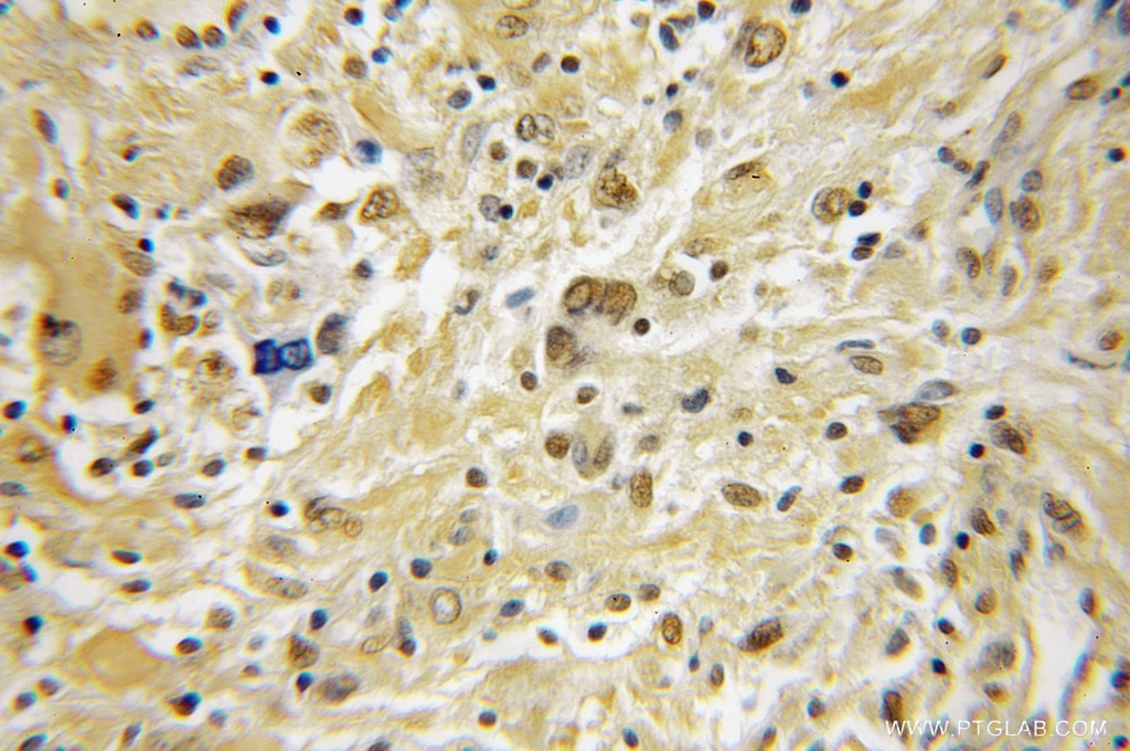 PRKACB IHC Immunohistochemical 12232-1-AP PRKACB Antibody DKFZp781I2452; MGC41879; MGC9320; PKACB