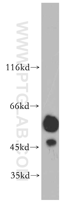 PRKACB western blot WB 12232-1-AP PRKACB Antibody DKFZp781I2452; MGC41879; MGC9320; PKACB