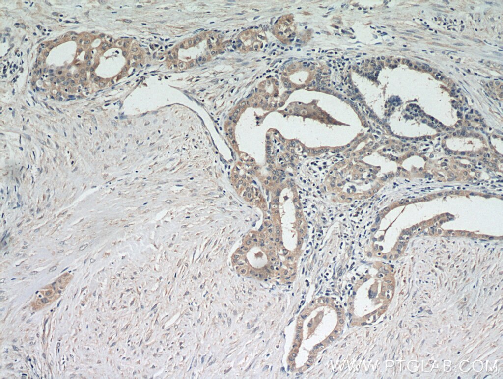 PRKCE IHC Immunohistochemical 20877-1-AP PRKCE Antibody MGC125656; MGC125657; PKCE; nPKC-epsilon