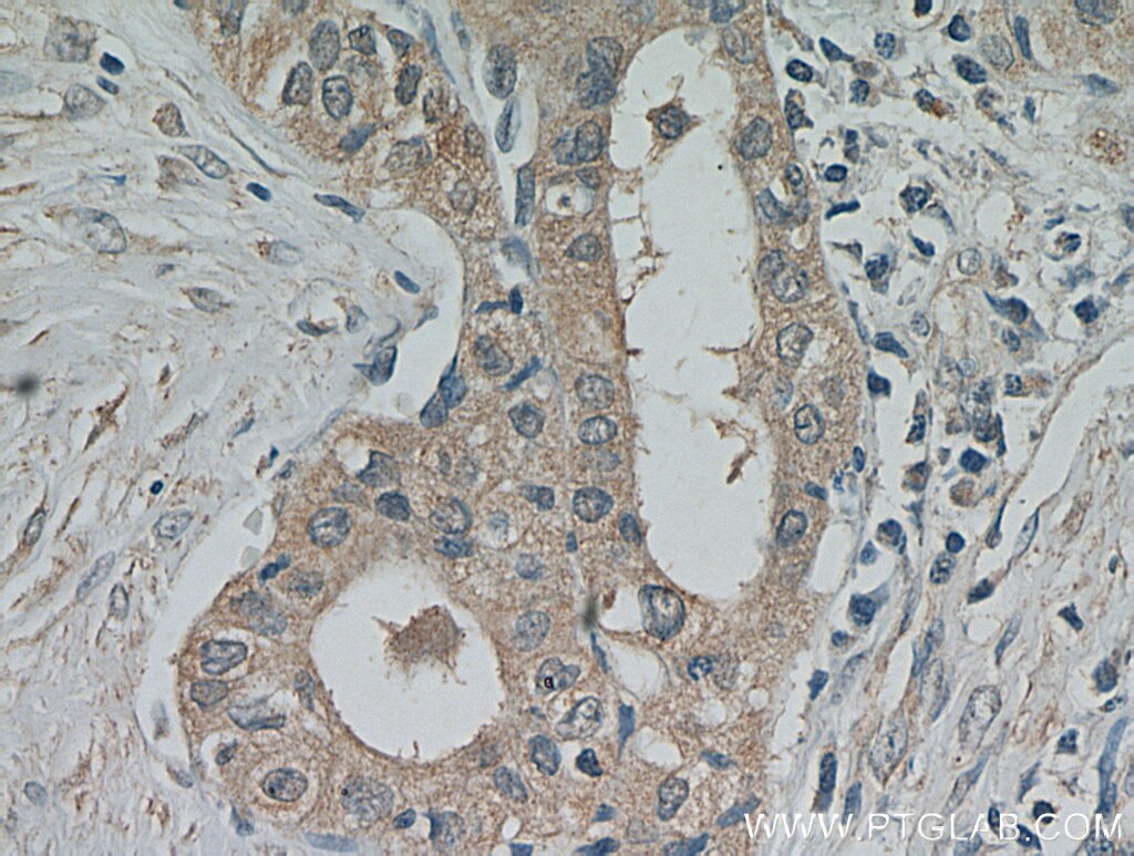 PRKCE IHC Immunohistochemical 20877-1-AP PRKCE Antibody MGC125656; MGC125657; PKCE; nPKC-epsilon