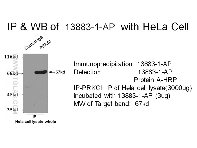 PRKCI IP 13883-1-AP PRKCI Antibody DXS1179E; MGC26534; PKCI; nPKC-iota