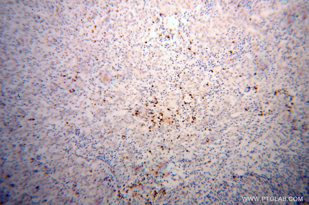 PRKCI IHC Immunohistochemical 13883-1-AP PRKCI Antibody DXS1179E; MGC26534; PKCI; nPKC-iota