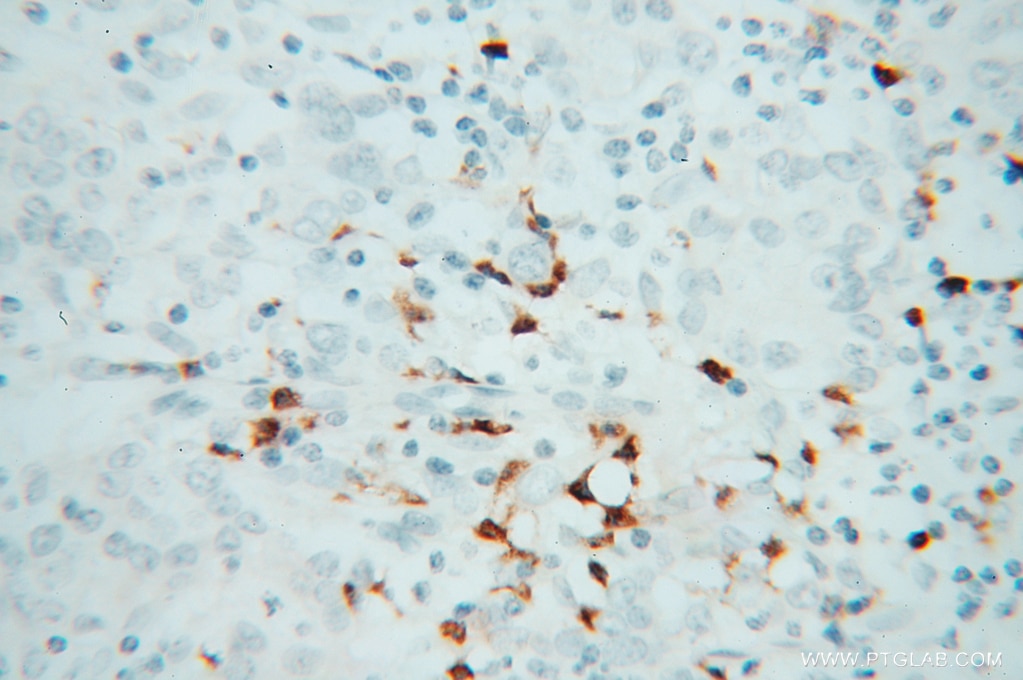PRKCI IHC Immunohistochemical 13883-1-AP PRKCI Antibody DXS1179E; MGC26534; PKCI; nPKC-iota