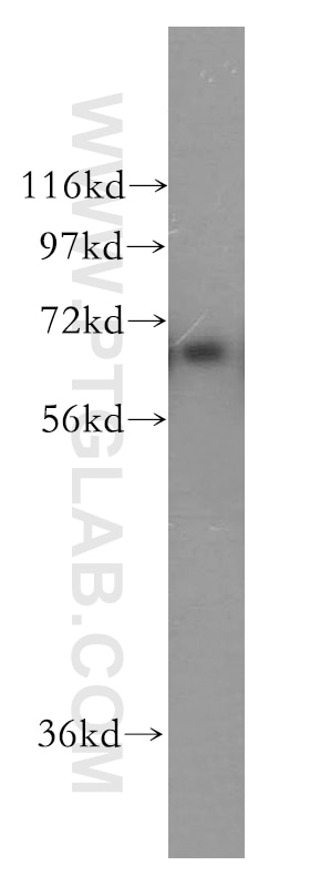 PRKCI western blot WB 13883-1-AP PRKCI Antibody DXS1179E; MGC26534; PKCI; nPKC-iota