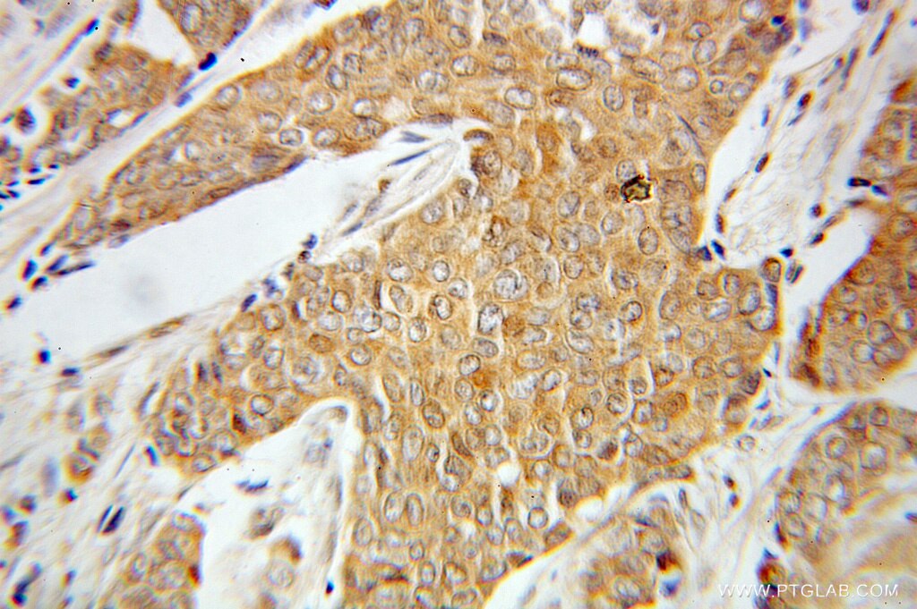 PRKCZ IHC Immunohistochemical 10860-1-AP PRKCZ Antibody PKC-ZETA; PKC2