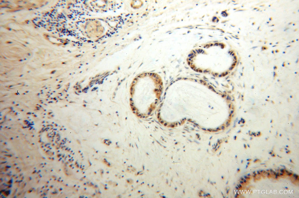 PRNP IHC Immunohistochemical 12555-1-AP PRNP Antibody ASCR; CD230; CJD; GSS; MGC26679; PRIP; PrP; PrP27-30; PrP33-35C; PrPc; prion