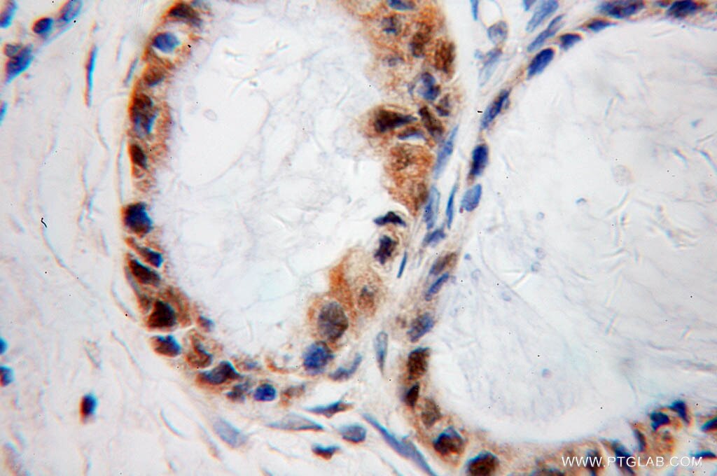 PRNP IHC Immunohistochemical 12555-1-AP PRNP Antibody ASCR; CD230; CJD; GSS; MGC26679; PRIP; PrP; PrP27-30; PrP33-35C; PrPc; prion