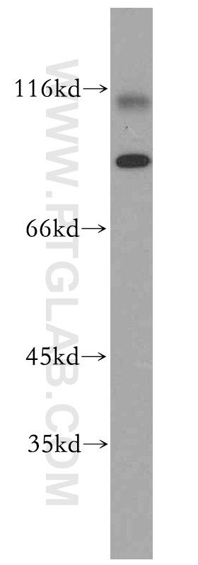 Y79 cells were subjected to SDS PAGE followed by western blot with 19946-1-AP(PROM1-1,2,3 Antibody) at dilution of 1:600 PROM1-1,2,3 western blot WB 19946-1-AP PROM1-1,2,3 Antibody AC133; CD133; CORD12; MCDR2; MSTP061; PROML1; RP41; STGD4