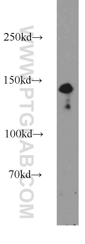 HEK-293 cells were subjected to SDS PAGE followed by western blot with 17392-1-AP(PRPF40A Antibody) at dilution of 1:1000 PRPF40A western blot WB 17392-1-AP PRPF40A Antibody FBP-11; FBP11; FLAF1; FLJ20585; FNBP3; HIP10; HYPA; NY-REN-6