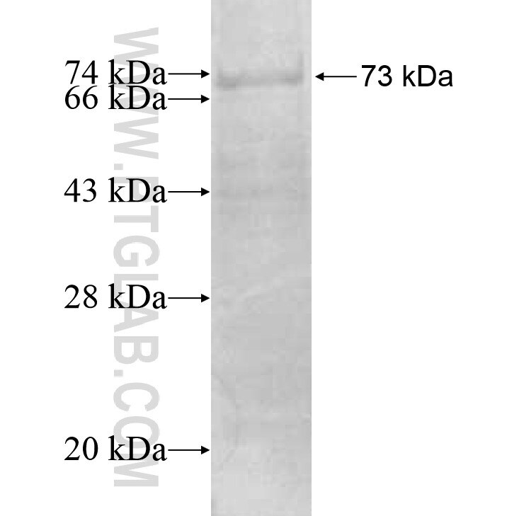 PRSS35 fusion protein ag11570 SDS-PAGE