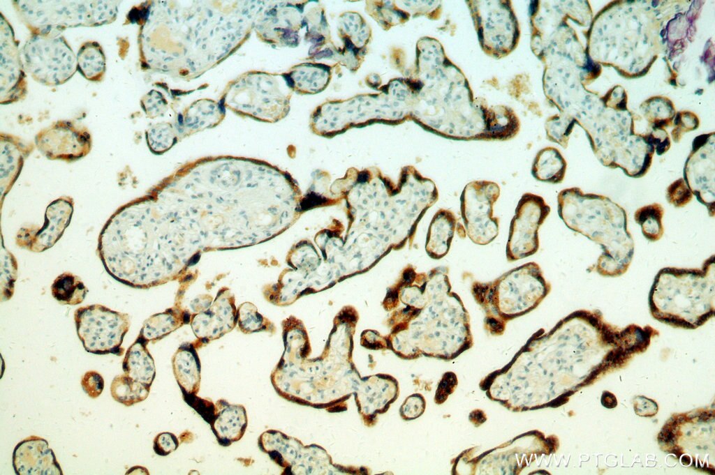 Immunohistochemistry of paraffin-embedded human placenta using 10902-2-AP(PSG4 Antibody) at Dilution 1:50 (under 10x lens) PSG4 IHC Immunohistochemical 10902-2-AP PSG4 Antibody PSG9