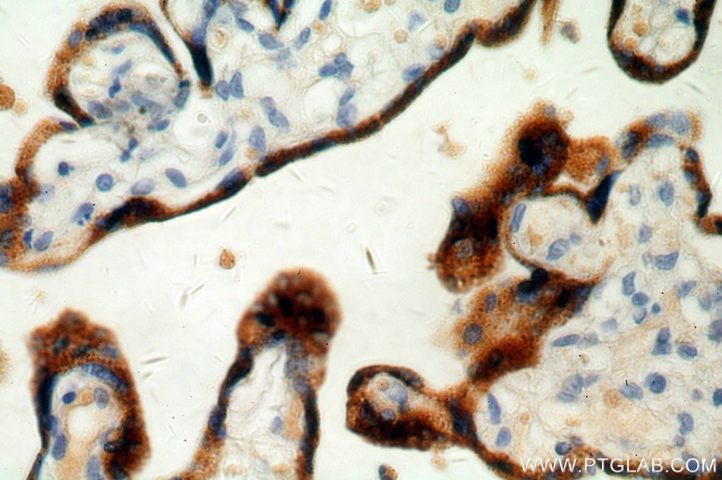Immunohistochemistry of paraffin-embedded human placenta using 10902-2-AP(PSG4 Antibody) at Dilution 1:50 (under 40x lens) PSG4 IHC Immunohistochemical 10902-2-AP PSG4 Antibody PSG9