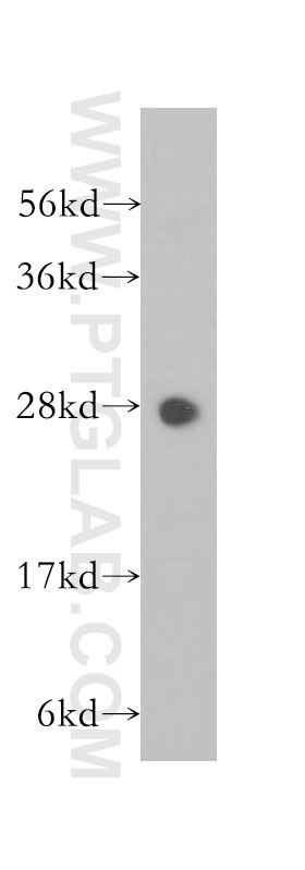 human lung tissue were subjected to SDS PAGE followed by western blot with 11887-1-AP(PSMA3 Antibody) at dilution of 1:800 PSMA3 western blot WB 11887-1-AP PSMA3 Antibody HC8; MGC12306; MGC32631; PSC3