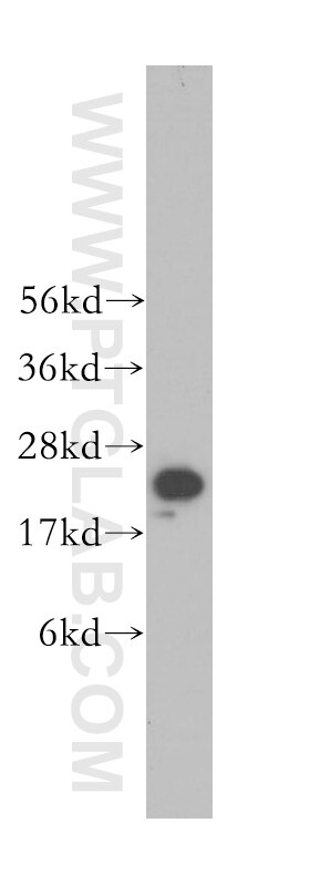 human brain tissue were subjected to SDS PAGE followed by western blot with 11573-1-AP(PSMA6 Antibody) at dilution of 1:500 PSMA6 western blot WB 11573-1-AP PSMA6 Antibody IOTA; MGC22756; MGC2333; MGC23846; PROS27; p27K