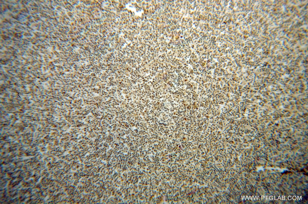 PSMB9 IHC Immunohistochemical 14544-1-AP PSMB9 Antibody LMP2; MGC70470; PSMB6i; RING12; beta1i