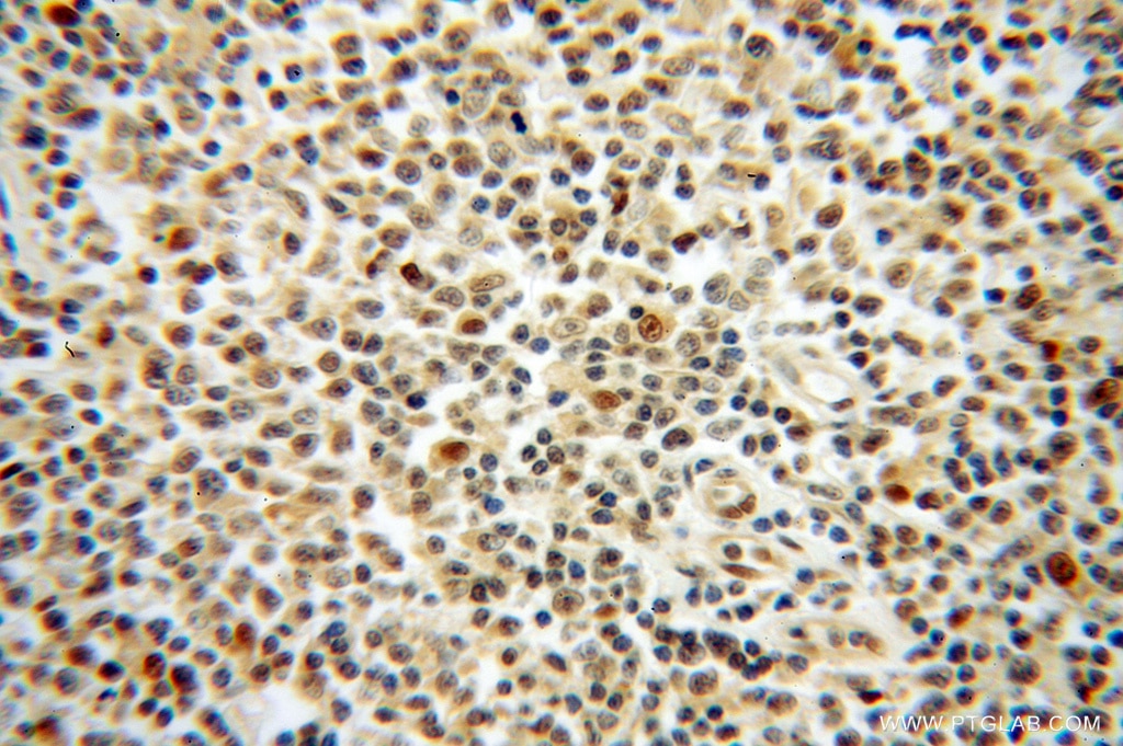 PSMB9 IHC Immunohistochemical 14544-1-AP PSMB9 Antibody LMP2; MGC70470; PSMB6i; RING12; beta1i