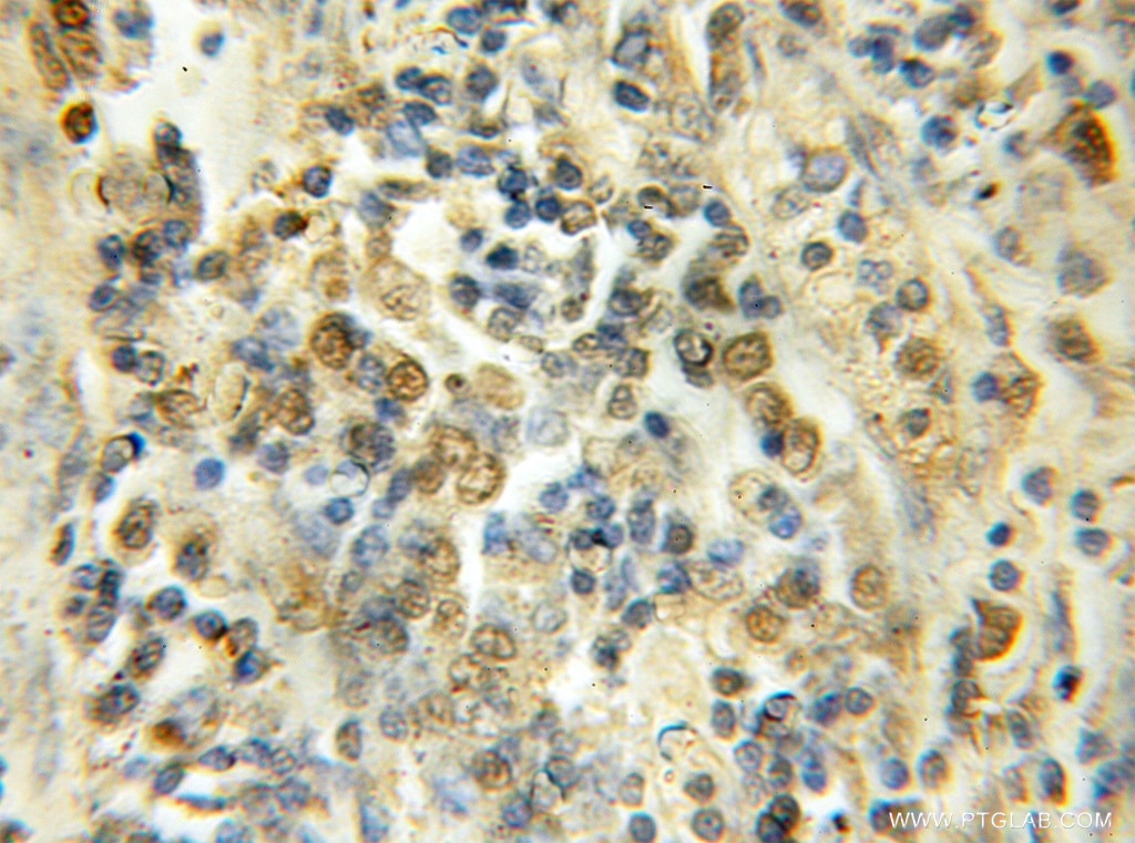 PSMC3IP IHC Immunohistochemical 11339-1-AP PSMC3IP Antibody GT198; HOP2; HUMGT198A; TBPIP