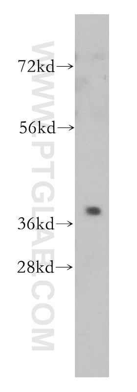 mouse kidney tissue were subjected to SDS PAGE followed by western blot with 14164-1-AP(PTGR2 Antibody) at dilution of 1:500 PTGR2 western blot WB 14164-1-AP PTGR2 Antibody DKFZp686P10120; FLJ39091; FLJ99229; PGR2; ZADH1
