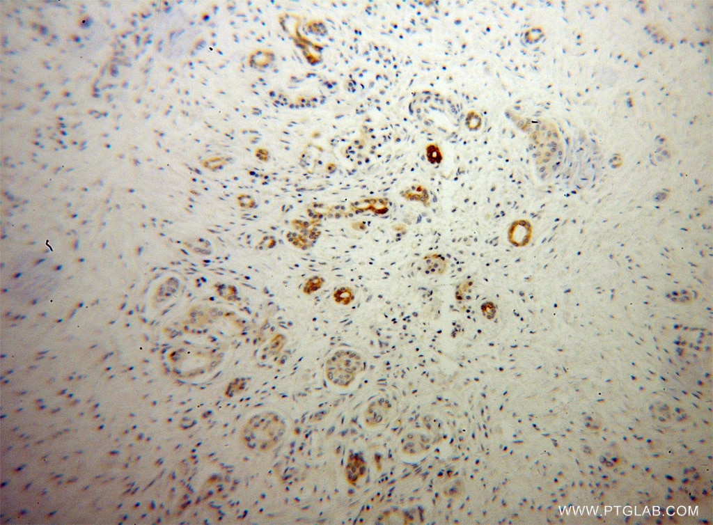 PTH2R IHC Immunohistochemical 14166-1-AP PTH2R Antibody PTHR2