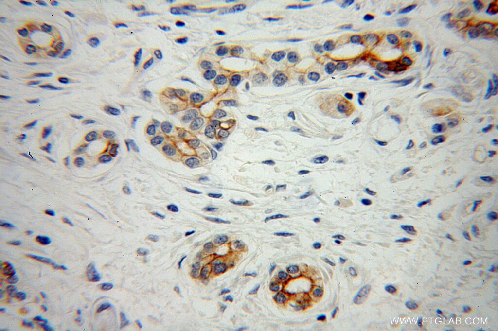 PTH2R IHC Immunohistochemical 14166-1-AP PTH2R Antibody PTHR2