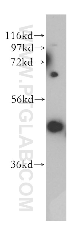 PURA western blot WB 17733-1-AP PURA Antibody PUR-ALPHA; PUR1; PURALPHA