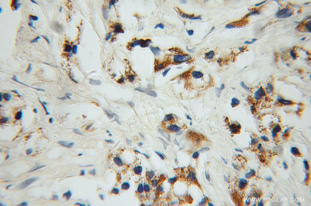PYCR1 IHC Immunohistochemical 13108-1-AP PYCR1 Antibody P5C; P5CR; PIG45; PP222; PYCR